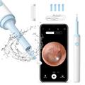 Inskam Find B Otoscope numérique WiFi pour le nettoyage des oreilles - Blanc